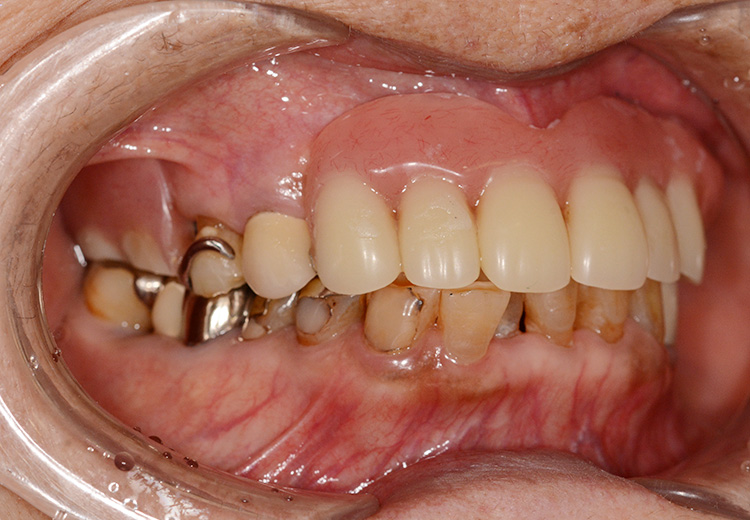 こさか歯科クリニックの症例