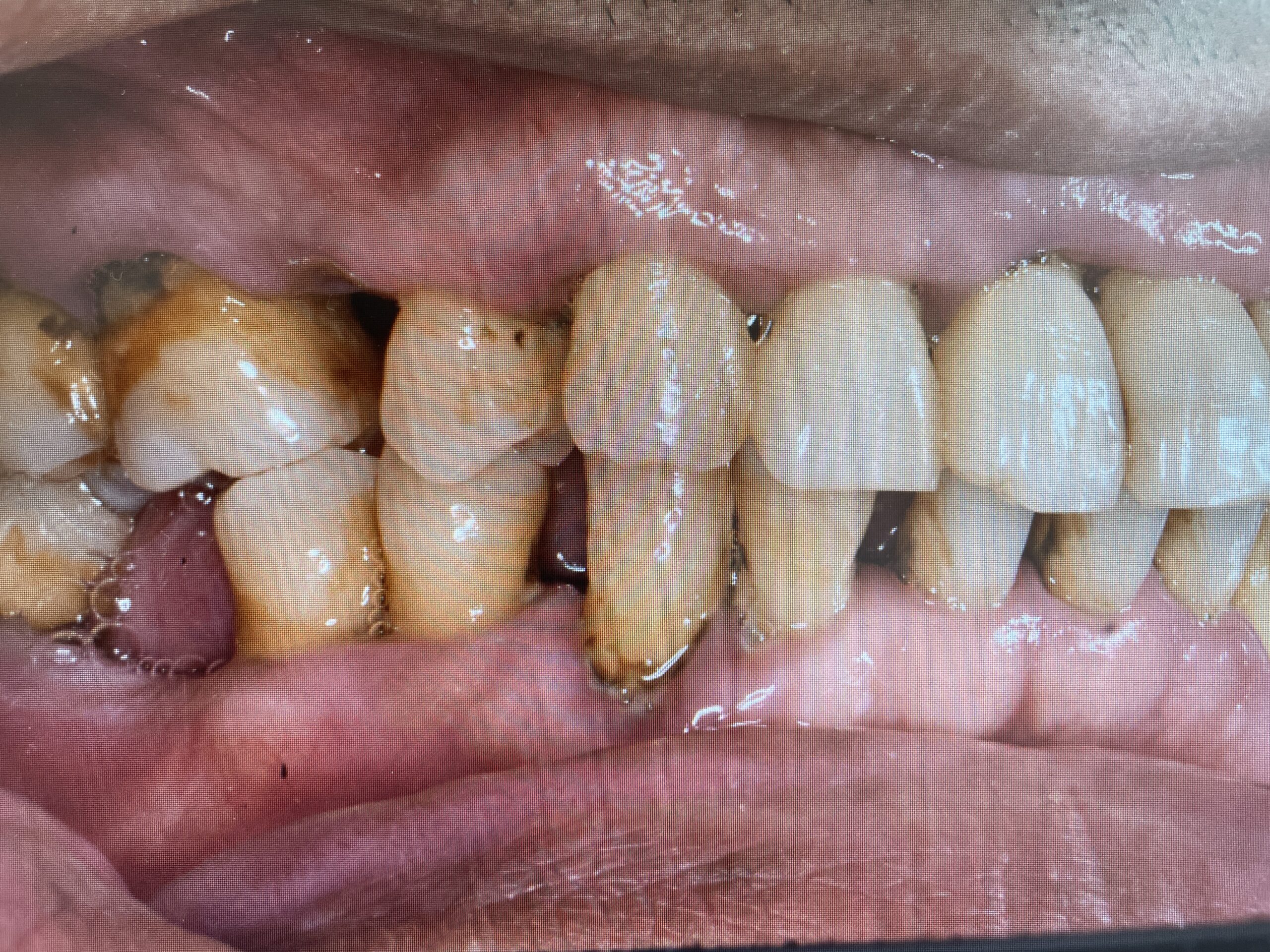 歯周病の原因、生活習慣 | こさか歯科クリニック（伊丹市、武庫之荘駅、歯科医院）口コミのある歯医者